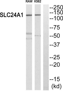 NCKX1 rabbit pAb Antibody