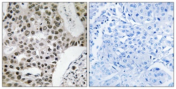 ZNF262 antibody