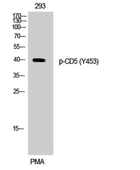 CD5 (phospho-Tyr453) antibody