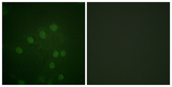ARK-2 (phospho Thr232) rabbit pAb Antibody