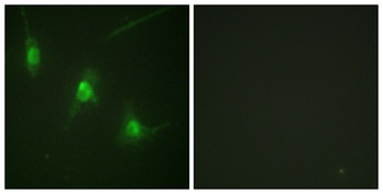 MSK1 (phospho Ser360) rabbit pAb Antibody