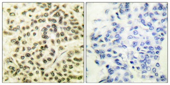 MAPKAPK-2 (phospho Thr334) rabbit pAb