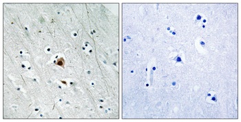 MAPKAPK-2 (phospho Ser272) rabbit pAb