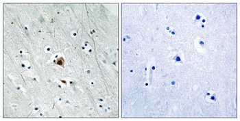 MAPKAPK-2 (phospho-Ser272) antibody