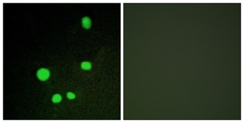 CRSP150 antibody