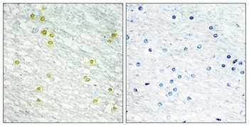CRSP150 rabbit pAb Antibody