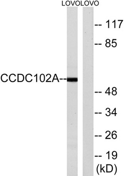 CCDC102A antibody