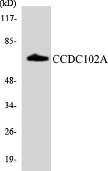 CCDC102A rabbit pAb Antibody