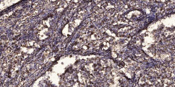 SFRS11 rabbit pAb Antibody