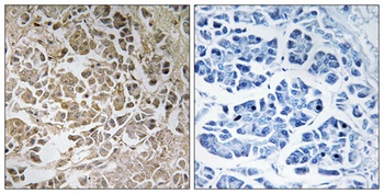 Peroxin 11γ rabbit pAb