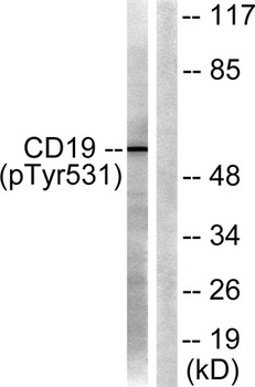 CD19 (phospho-Tyr531) antibody