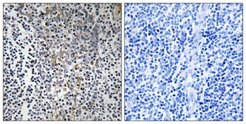 Ribosomal Protein L23 rabbit pAb