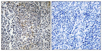 Ribosomal Protein L23 antibody