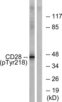 CD28 (phospho Tyr218) rabbit pAb Antibody
