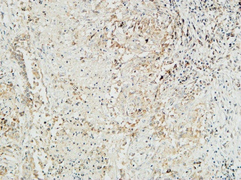 Mucin 16 rabbit pAb