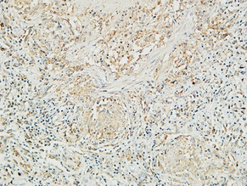 Mucin 16 rabbit pAb Antibody