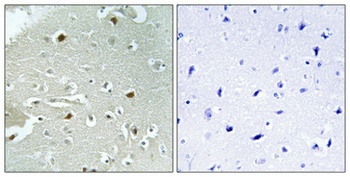 HAND1 (phospho Ser98) rabbit pAb