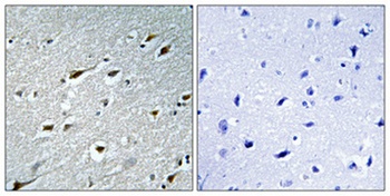 HAND1 antibody