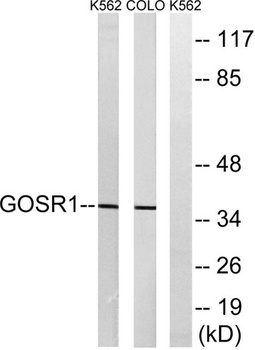 GS28 antibody
