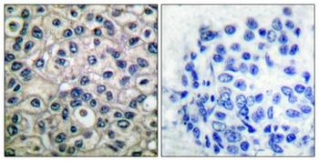 p130 Cas (phospho-Tyr410) antibody