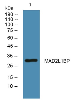 MAD2L1BP rabbit pAb