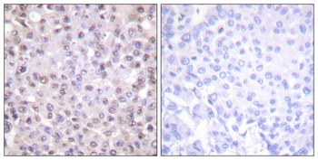 N-CoR rabbit pAb