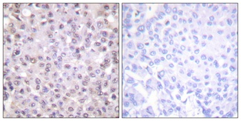 N-CoR antibody