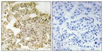 eIF5B antibody