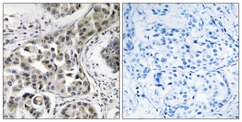 RN-tre antibody