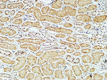 CD79a antibody