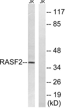 RASSF2 antibody