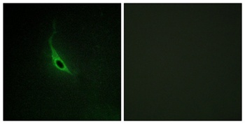 p164-RhoGEF antibody