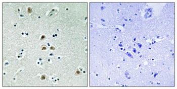 Cdk1/Cdc2 (phospho-Thr161) antibody