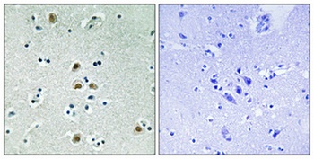 Cdk1/Cdc2 (phospho Thr161) rabbit pAb