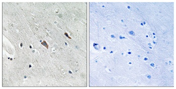 Gab 2 (phospho Tyr643) rabbit pAb