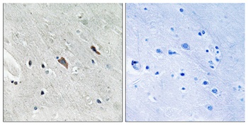 Gab 2 (phospho-Tyr643) antibody