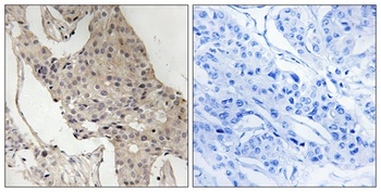 Gab 2 (phospho Ser623) rabbit pAb