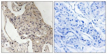 Gab 2 (phospho-Ser623) antibody