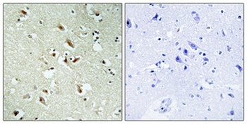 POM121 rabbit pAb