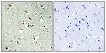 POM121 antibody