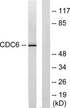 Cdc6 antibody
