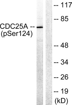 Cdc25A (phospho Ser124) rabbit pAb Antibody