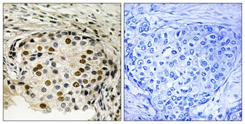 OSR1 (phospho Thr185) rabbit pAb