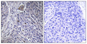 hnRNP DL antibody