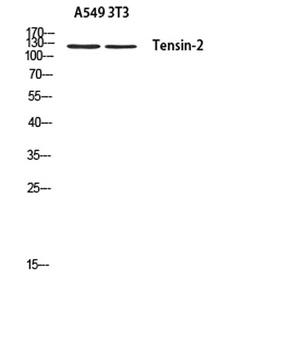 Tensin-2 rabbit pAb Antibody