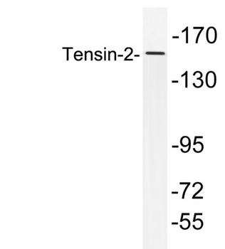 Tensin-2 rabbit pAb Antibody