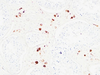 Karyopherin α2 rabbit pAb Antibody