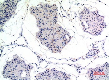 Thrombospondin 2 rabbit pAb