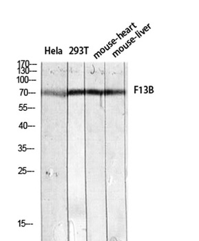 Factor XIII B antibody