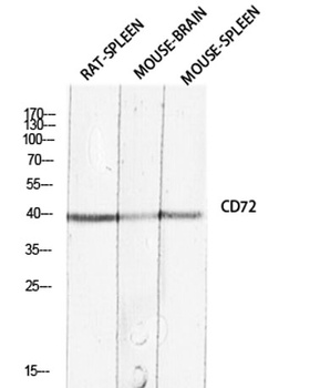 CD72 antibody